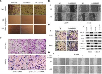 Functional role of MicroRNA/PI3K/AKT axis in osteosarcoma